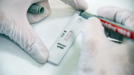 
МОЗ назвало долю украинцев с антителами к COVID-19
